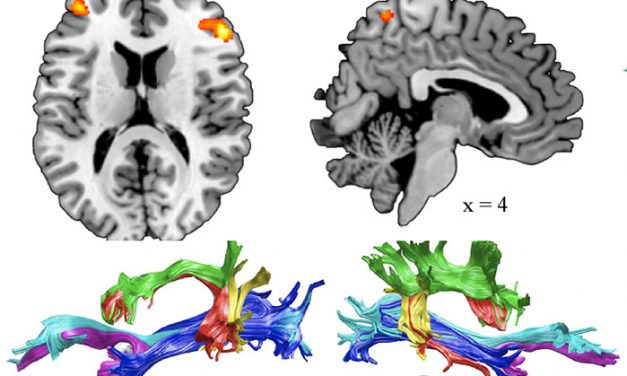 La extravagancia lingüística de una ciudad española intriga a neurocientíficos