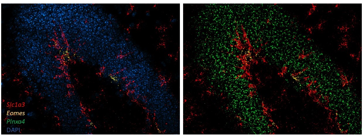 Elaboran un mapa molecular detallado del camino que sigue una célula madre del cerebro adulto hasta convertirse en una neurona madura